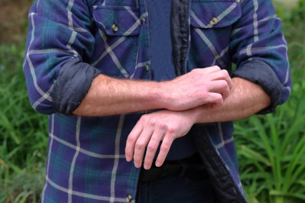 Eczéma des mains : guide complet pour un soulagement efficace