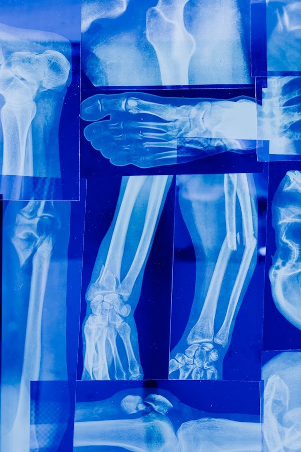 Chirurgie orthopédique à paris : vers une nouvelle mobilité